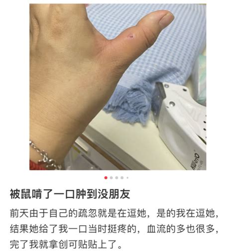 被老鼠咬ptt|Re: [問卦] 認真問：被老鼠咬了有點深怎麽處理 有